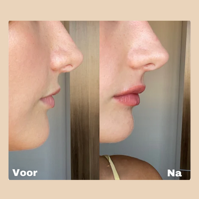 Extreme Lip Plumper